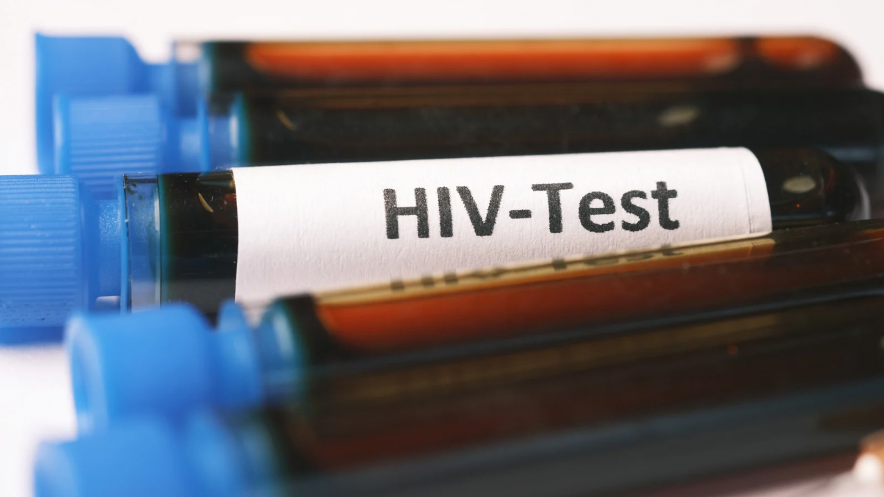 Ilustrasi HIV AIDS