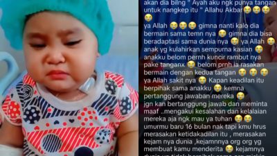 Balita di Bima Kehilangan Tangan, Diduga Malapraktik Infus