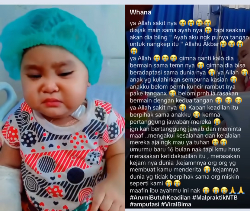 Balita di Bima Kehilangan Tangan, Diduga Malapraktik Infus