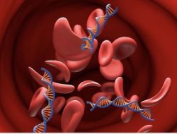 Puasa Aman, Tekanan Darah Terkendali: Tips Pola Makan Sehat bagi Penderita Hipertensi Saat Ramadan